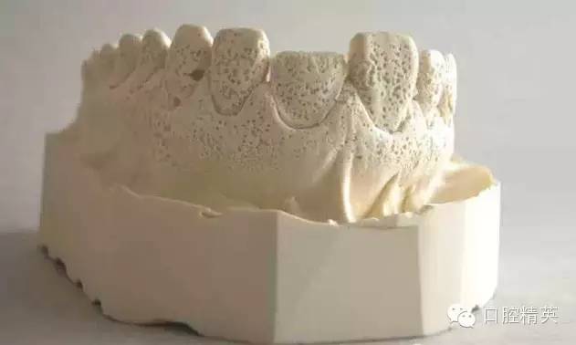 牙模质量的重要性及其影响因素