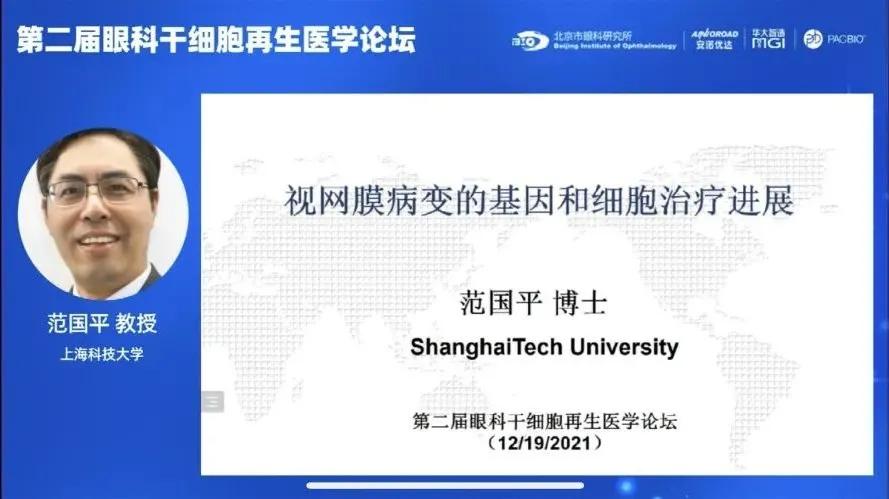 色素上皮细胞，生物学中的关键角色