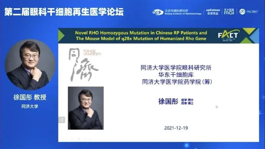 视网膜色素变性干细胞，未来治疗的新希望