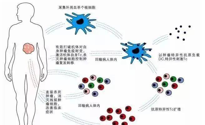 细胞间水肿，理解其影响与机制