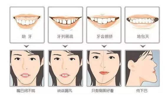 ICL术后带眼罩的重要性及其相关注意事项
