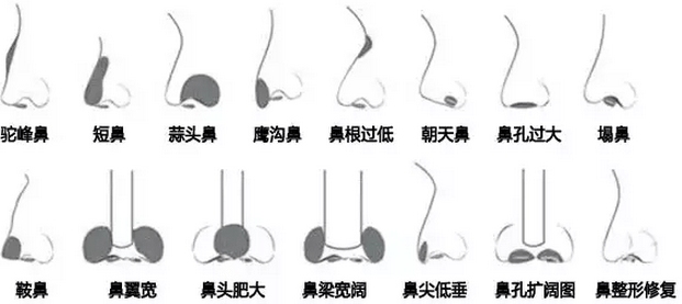 看鼻子挂什么科，深入了解鼻部问题及其对应科室