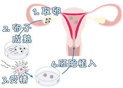 关于取卵之前排卵的探讨